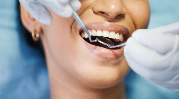 Best Urgent Dental Care  in Desnso, CA